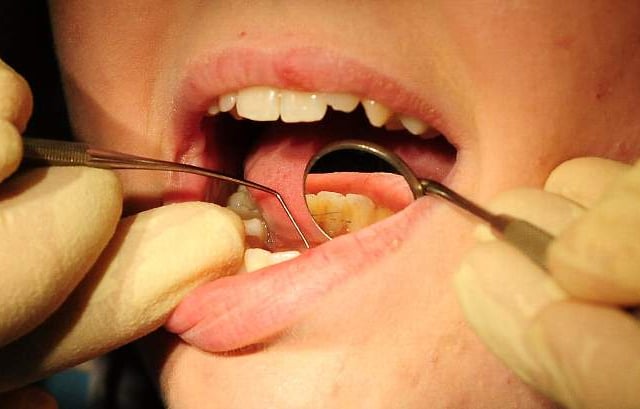 Just a third of Cornwall adults see their dentist during pandemic