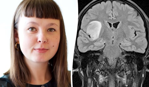 Artist documents her brain tumour health journey