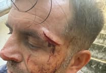 Postmaster criticises police after he was left scarred